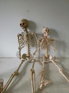 Life-Size and Child Anatomical Human Skeleton Models, Fully Articulated and Framed Chiropractic Educational Posters: "Damaging Effects of Forward Head Posture" & "Cause & Effect"