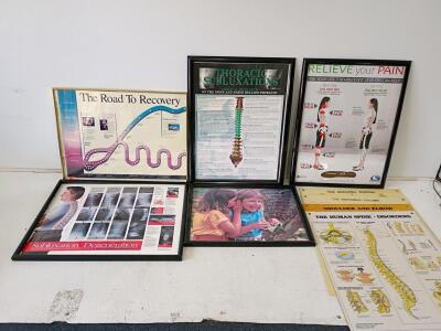 Lot of 9 Anatomical Educational Posters/Charts &ndash; Chiropractic and Medical Themes, Framed and Unframed