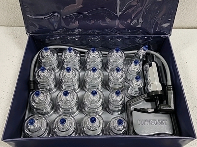 AcuZone Cupping Set